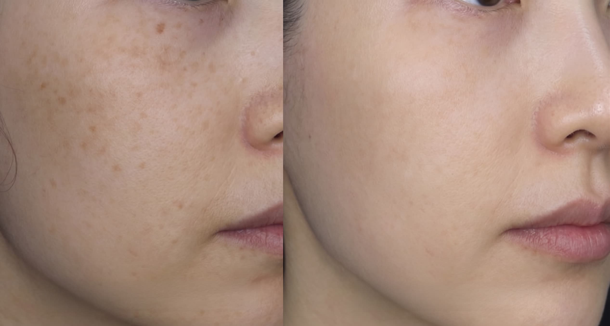 before-after