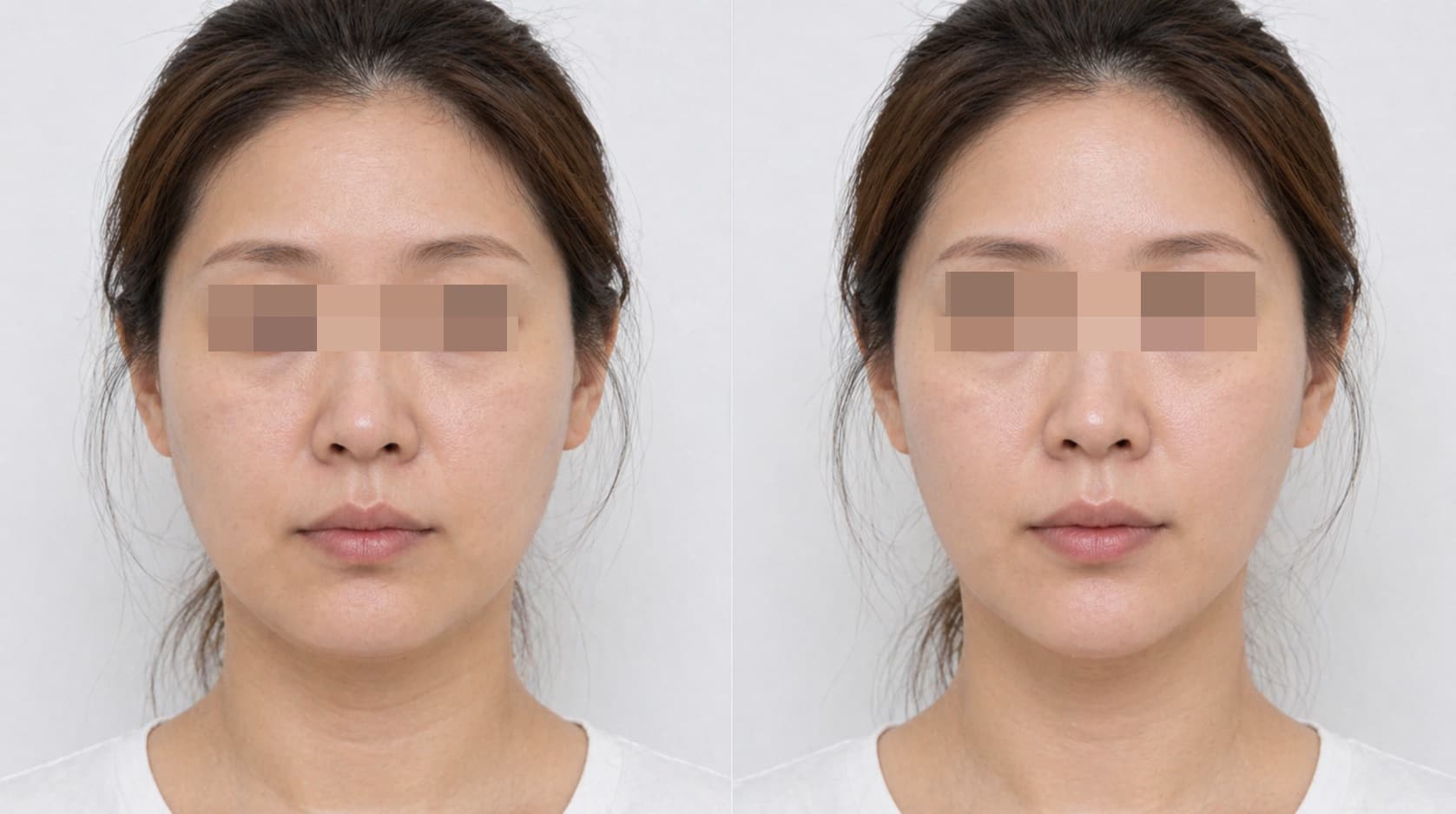 before-after