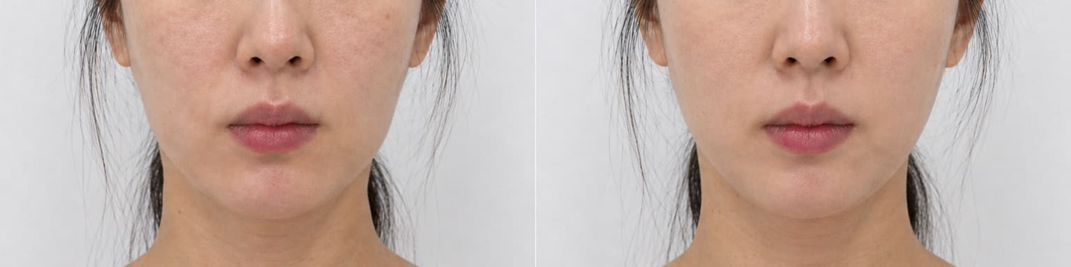 before-after
