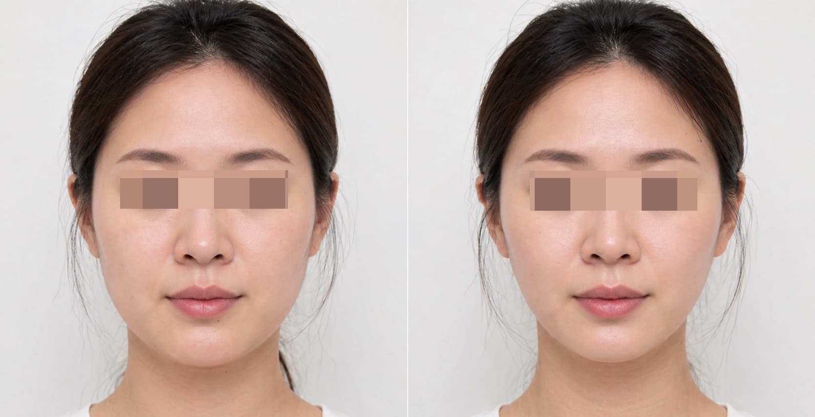 before-after