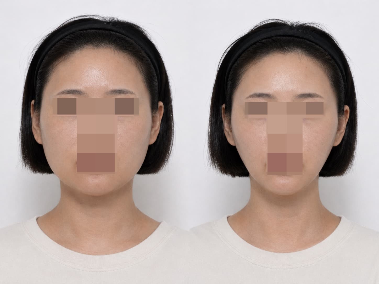 before-after