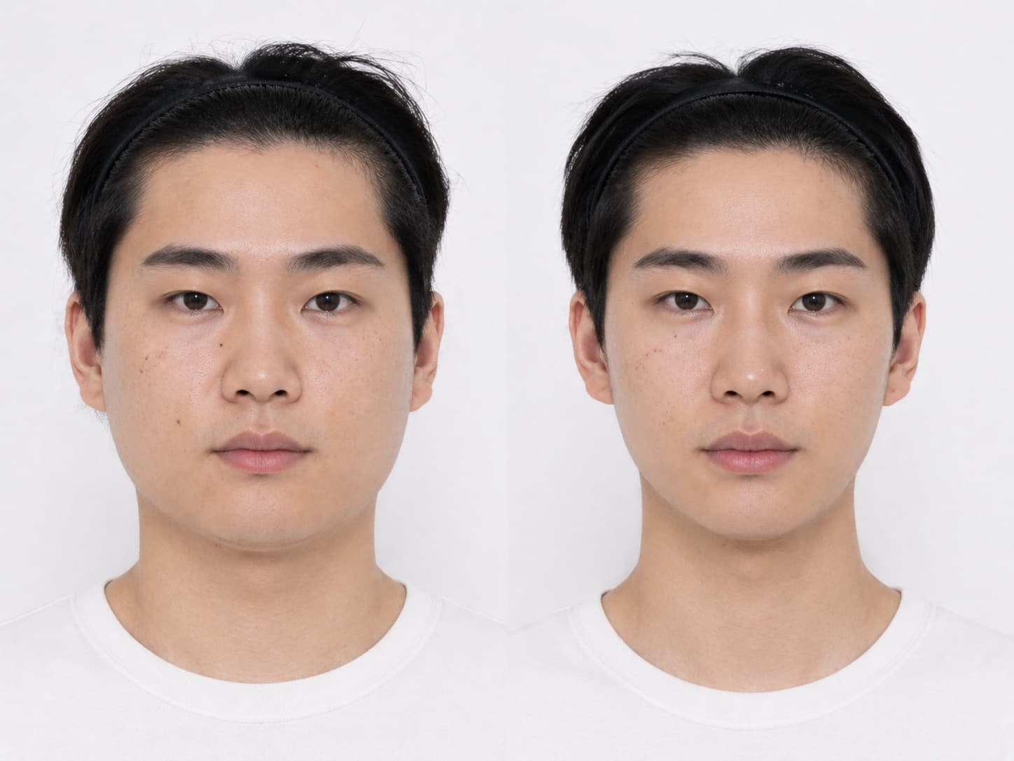 before-after