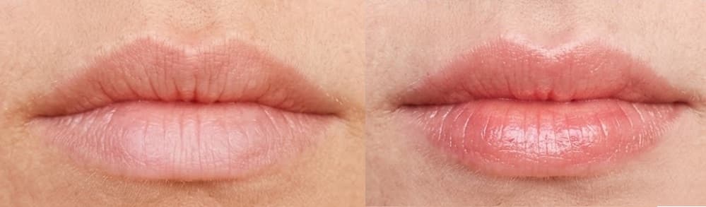 before-after