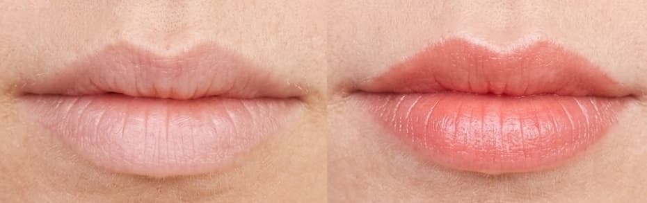 before-after