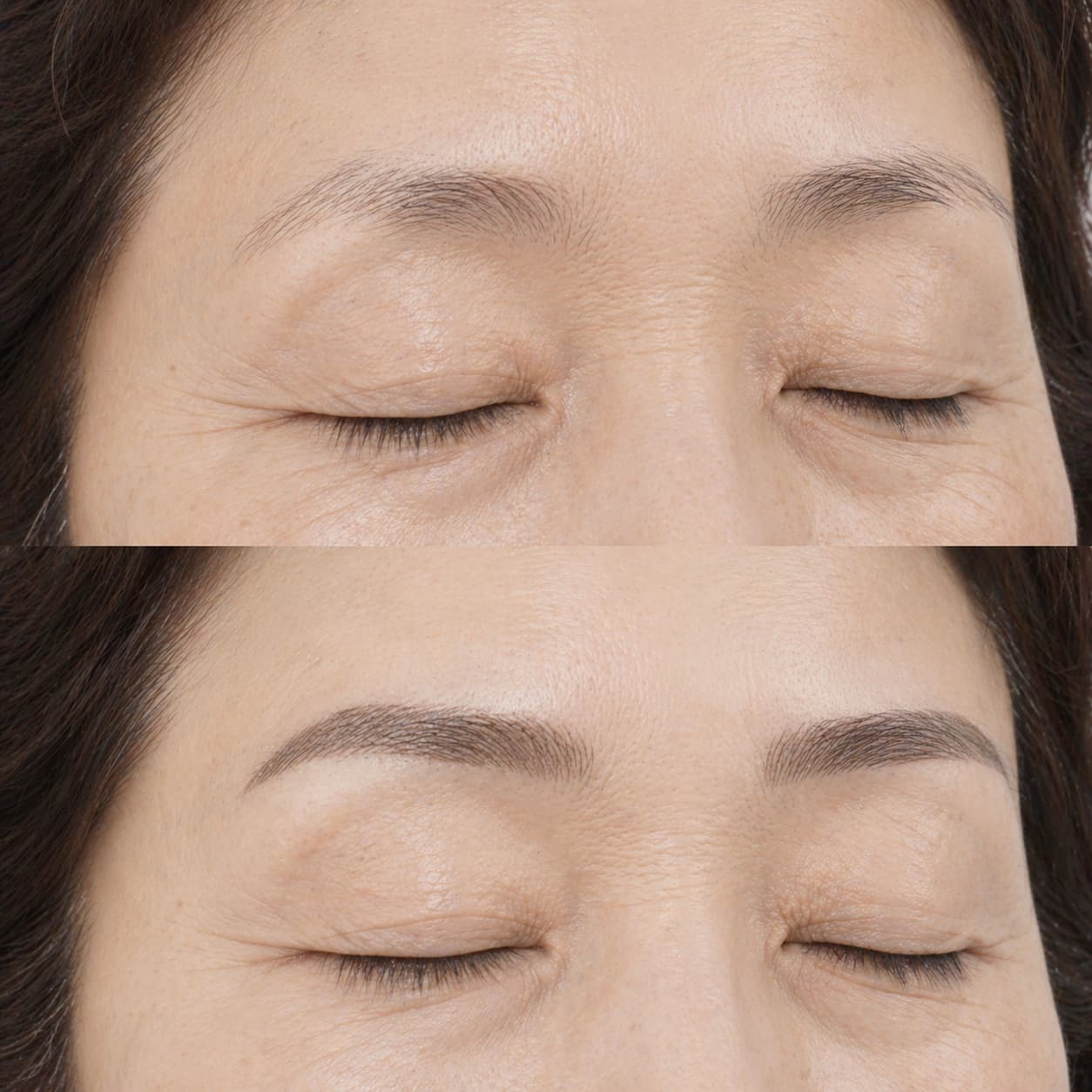 before-after