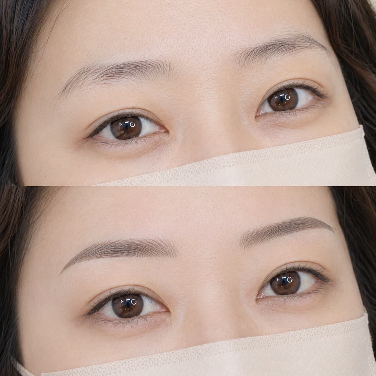 before-after