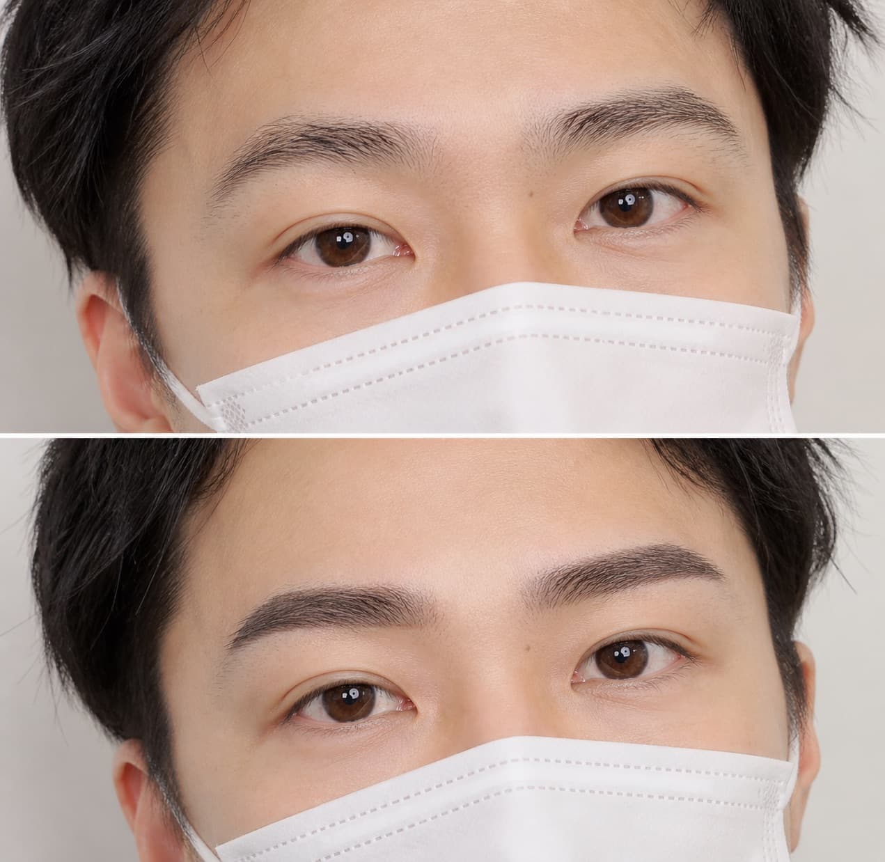 before-after