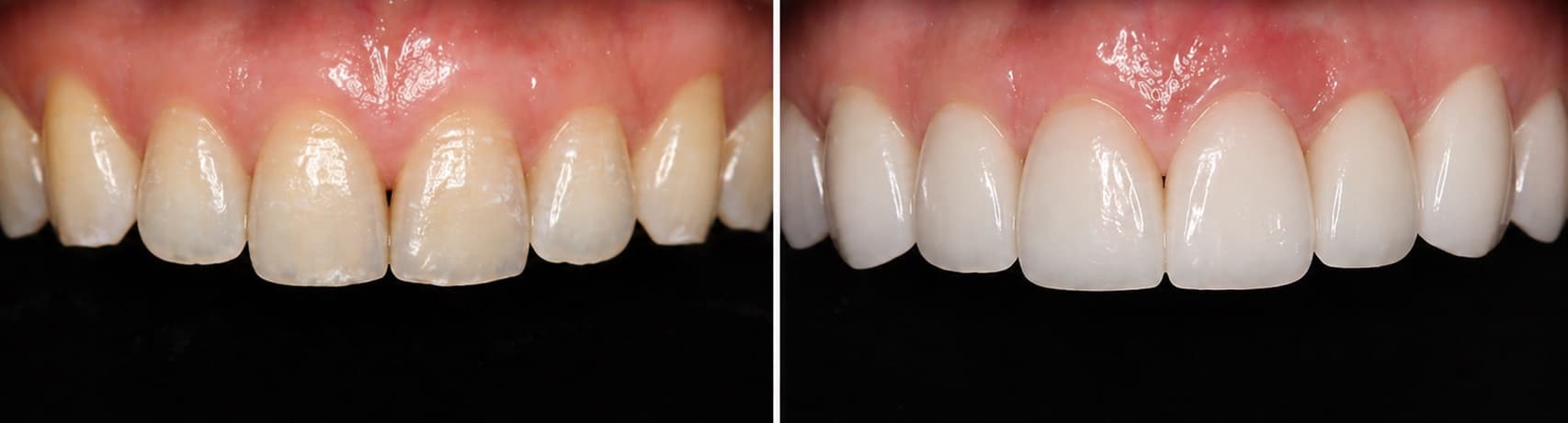 before-after