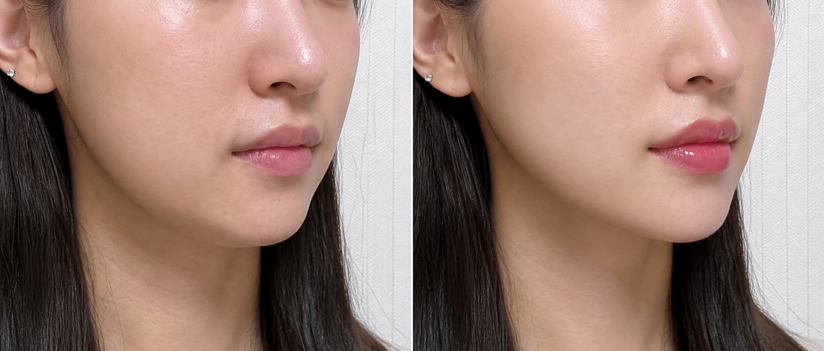 before-after