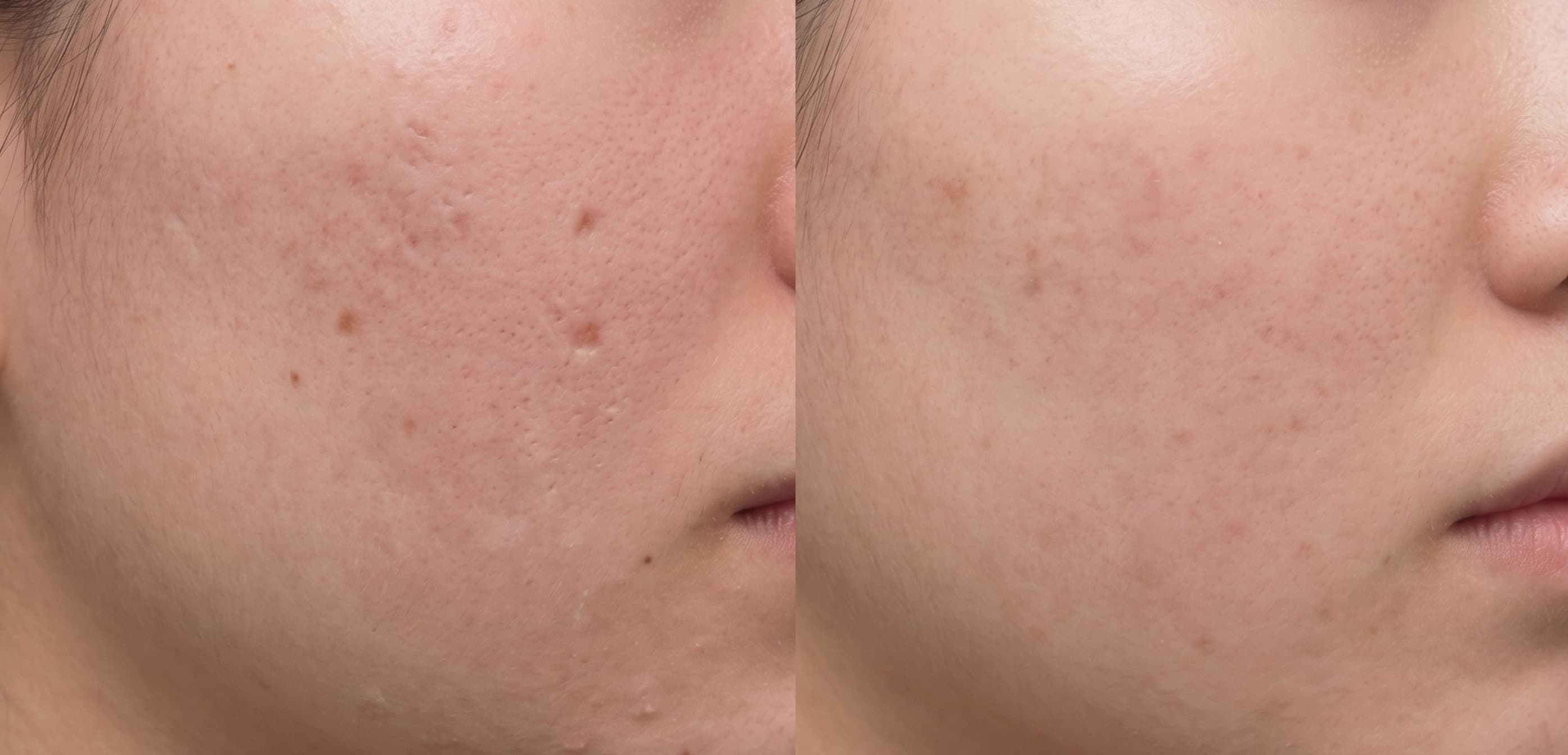 before-after