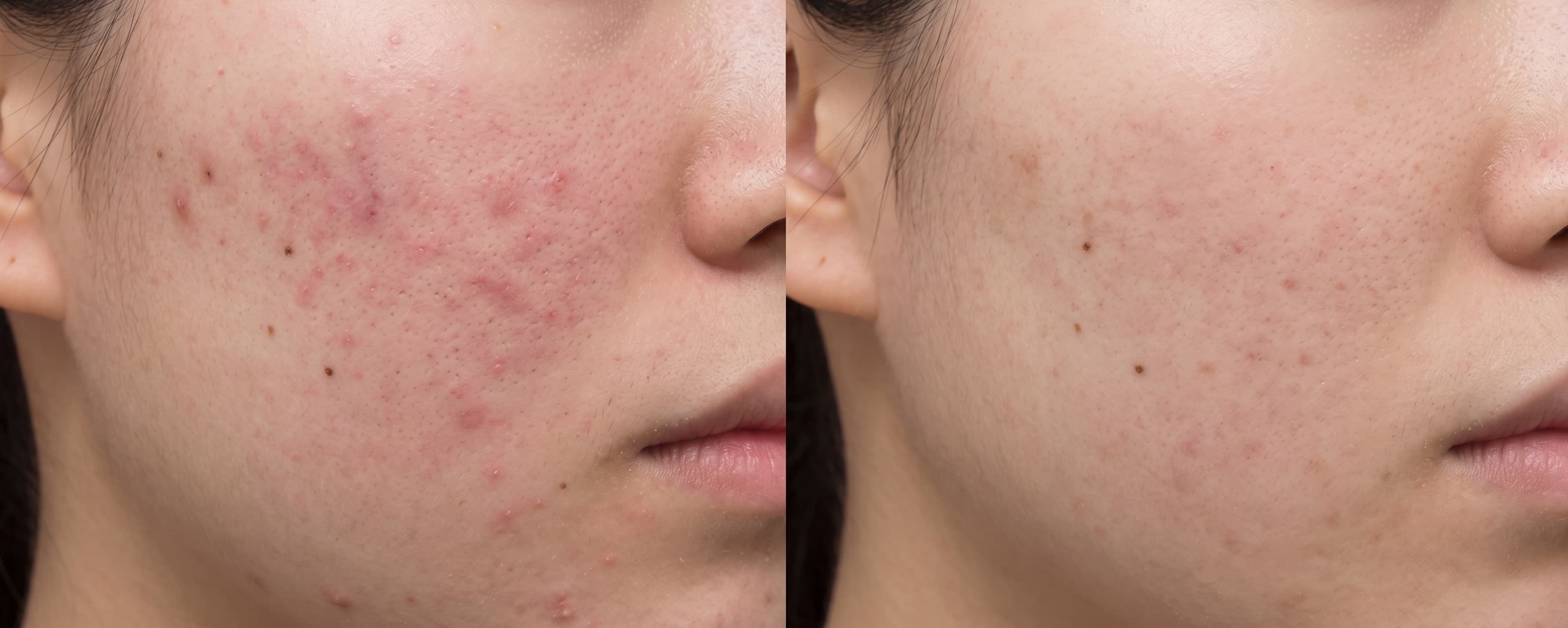 before-after