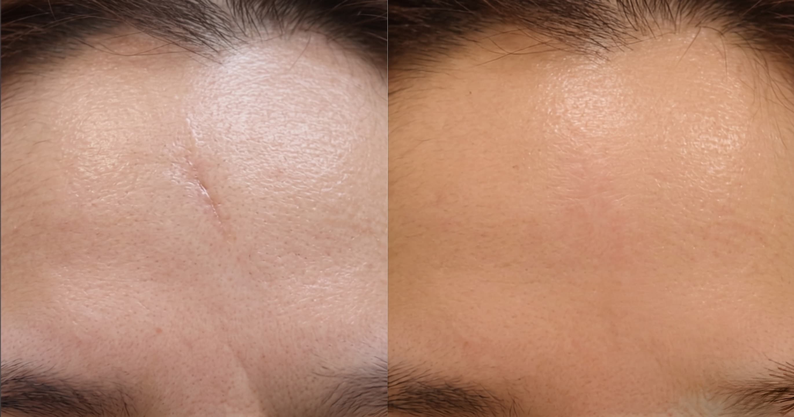 before-after