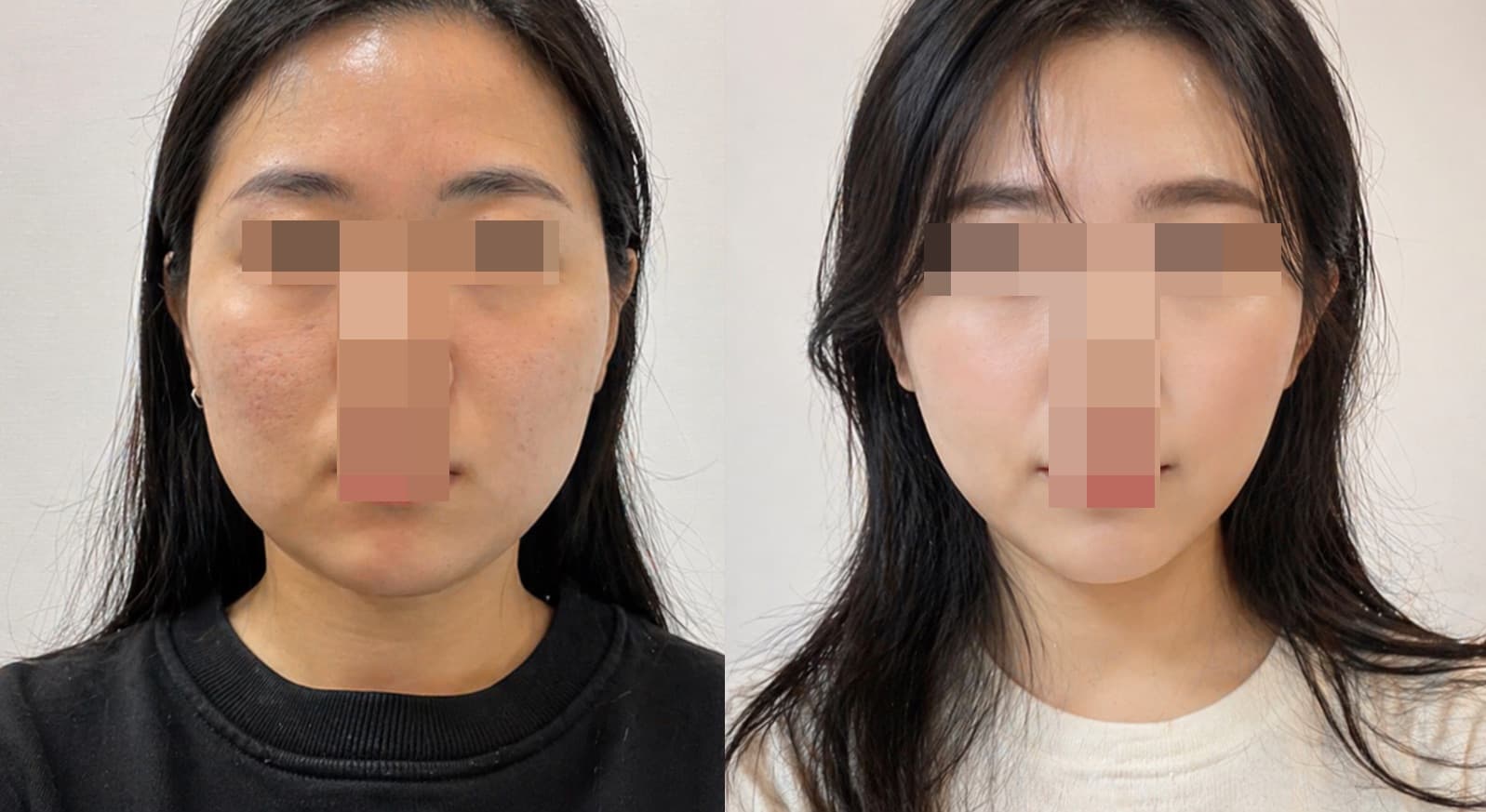 before-after