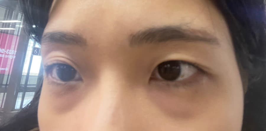 before-after