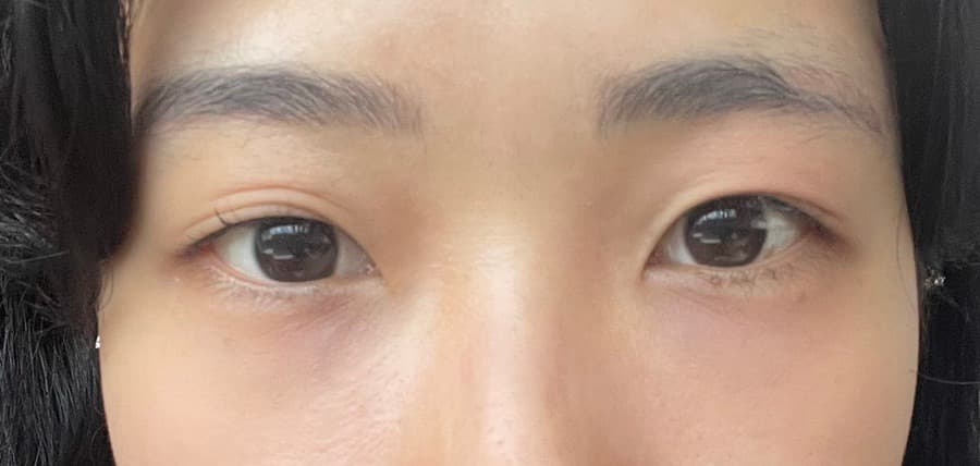 before-after
