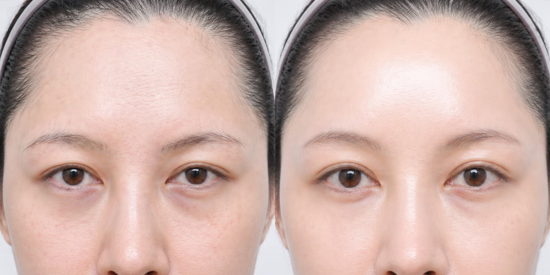 before-after
