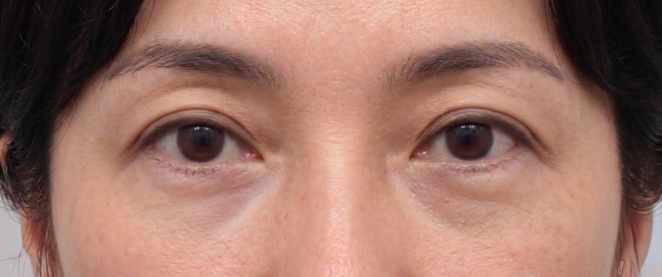 before-after