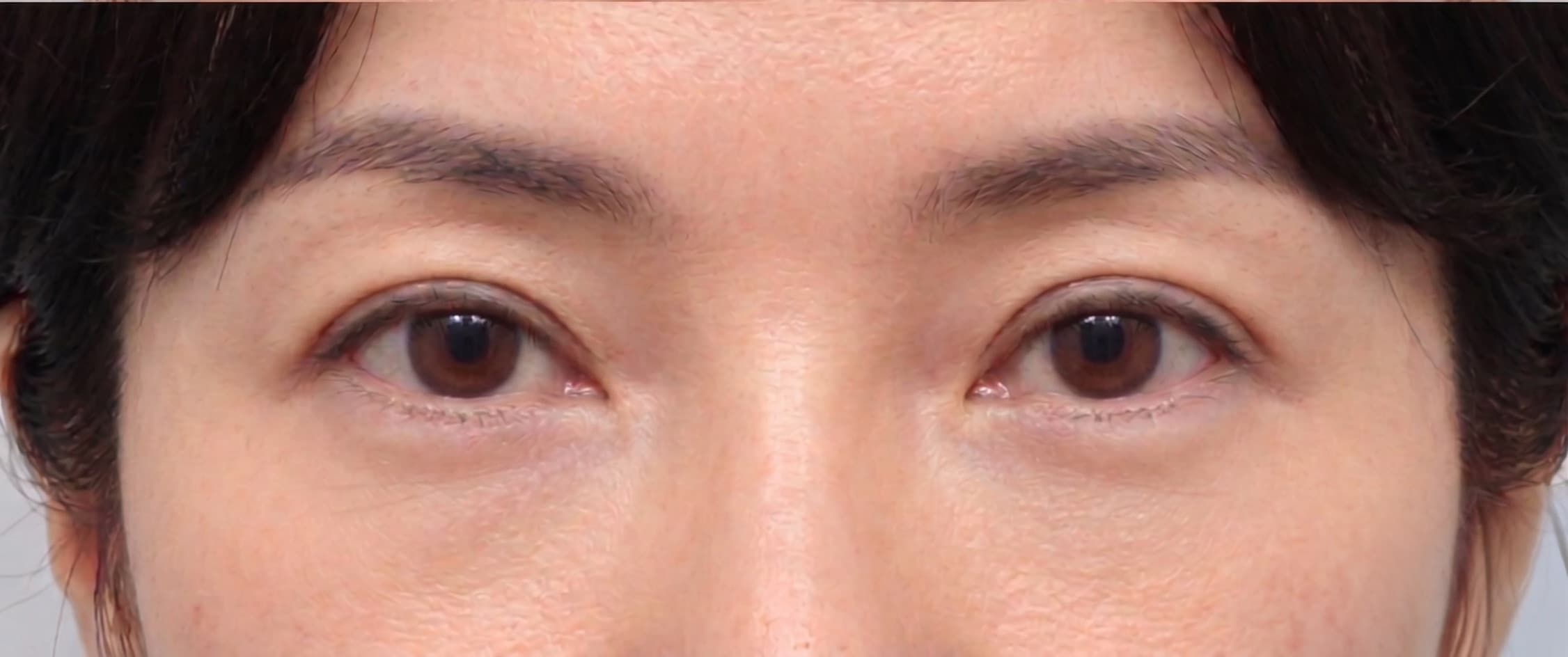 before-after