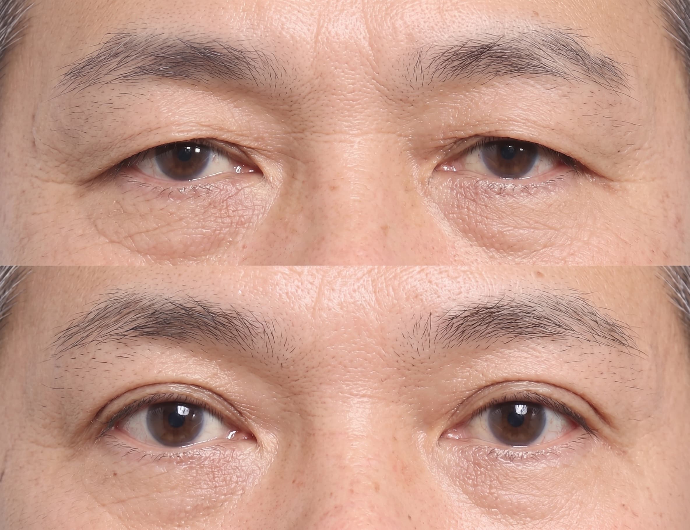 before-after