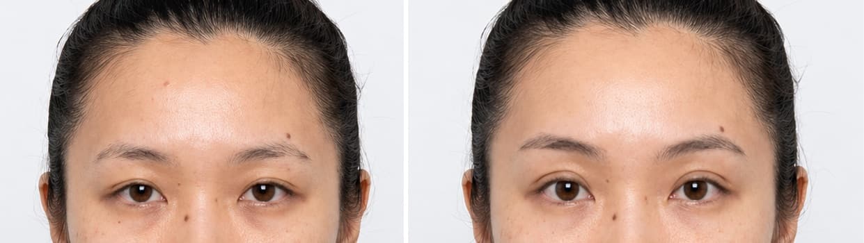 before-after