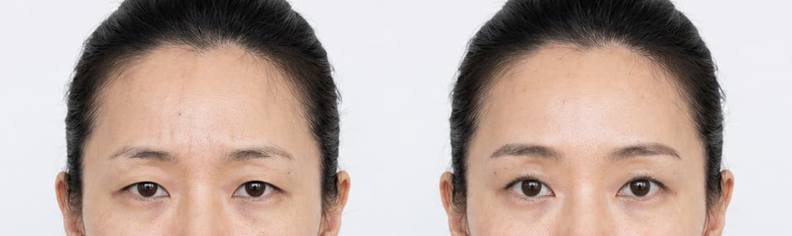 before-after