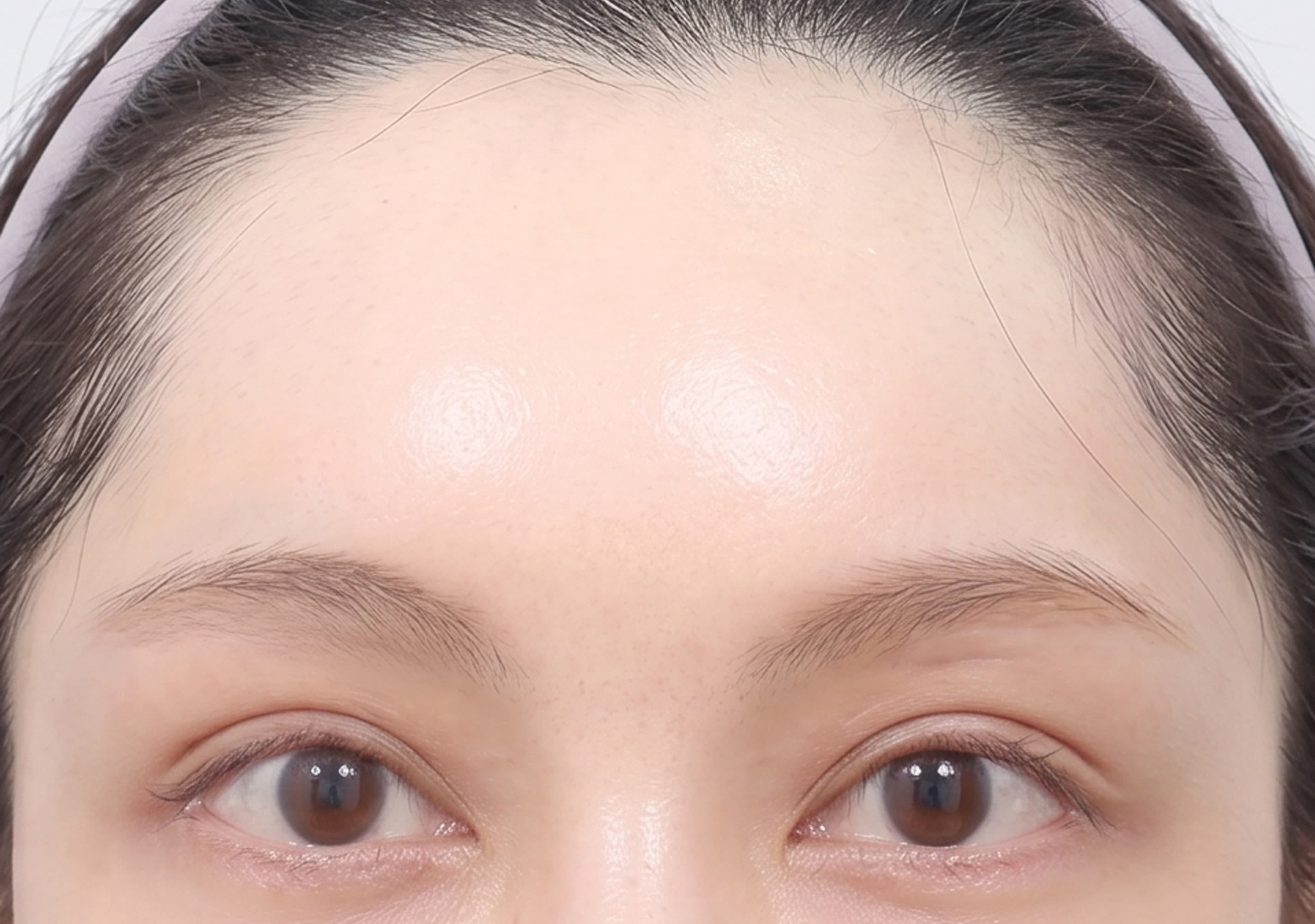 before-after
