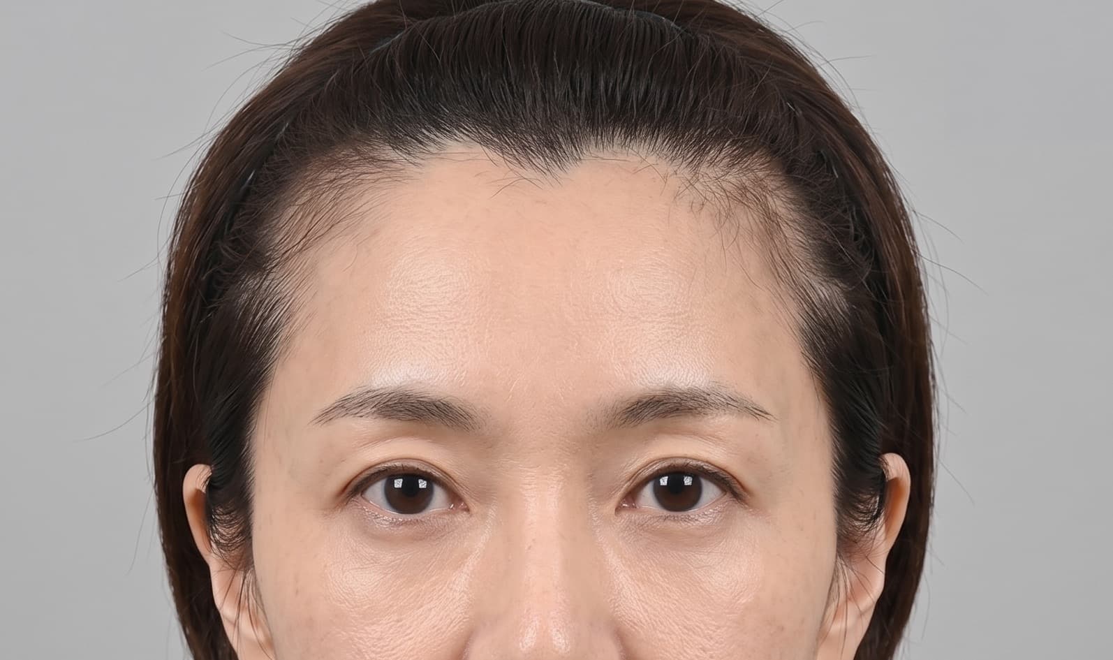 before-after