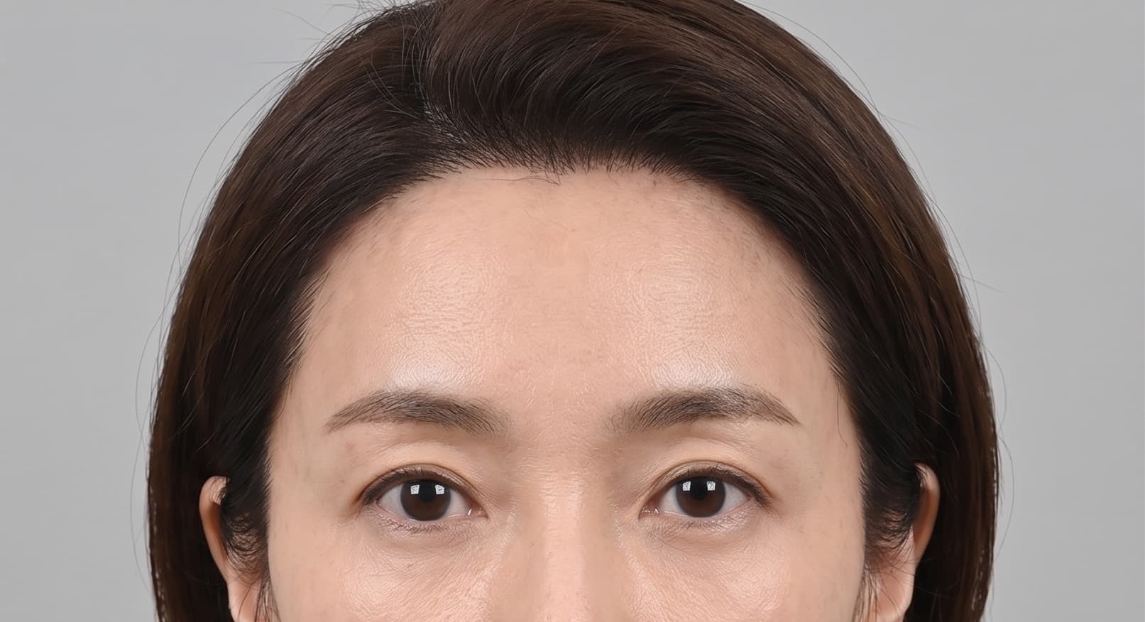before-after