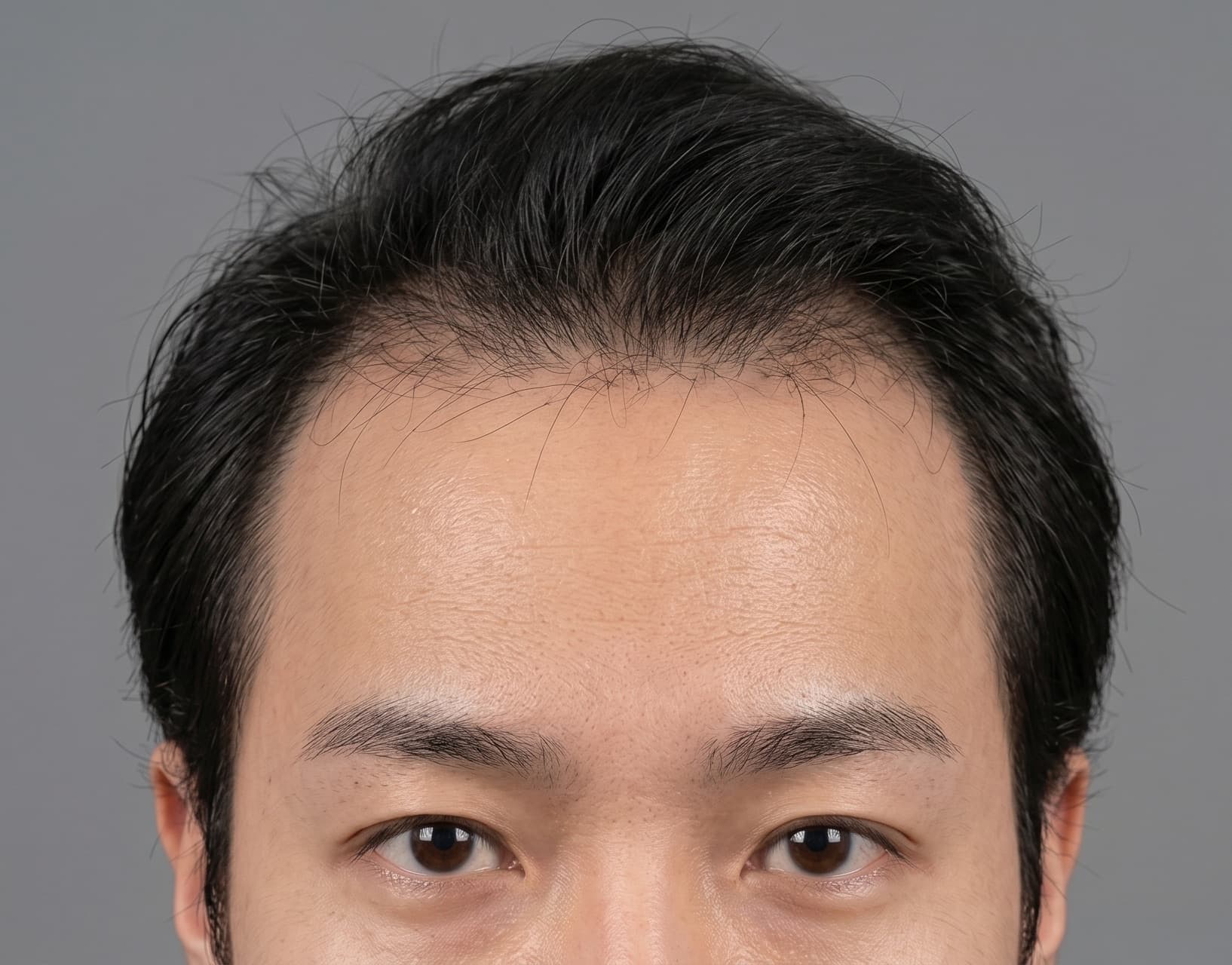 before-after