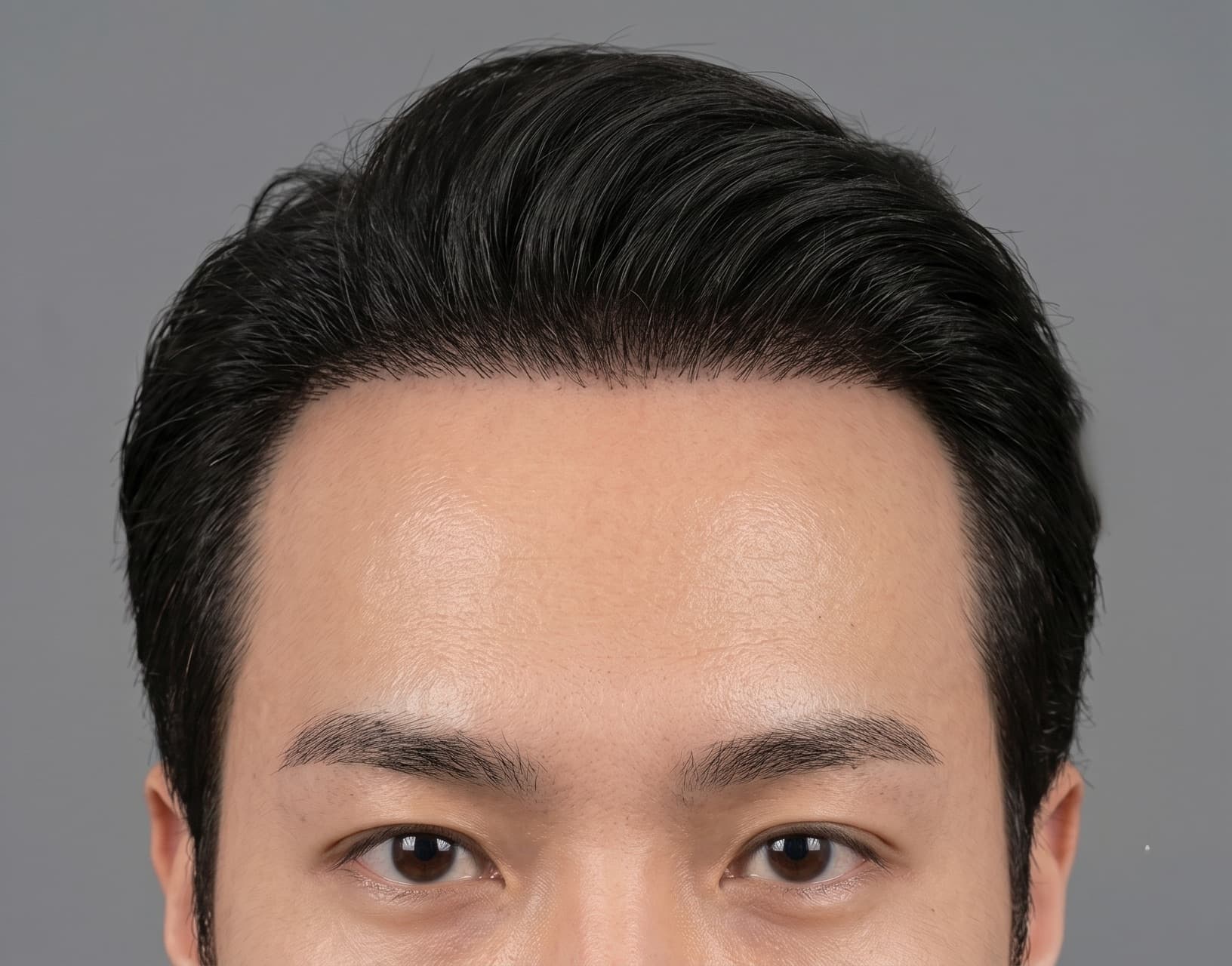 before-after
