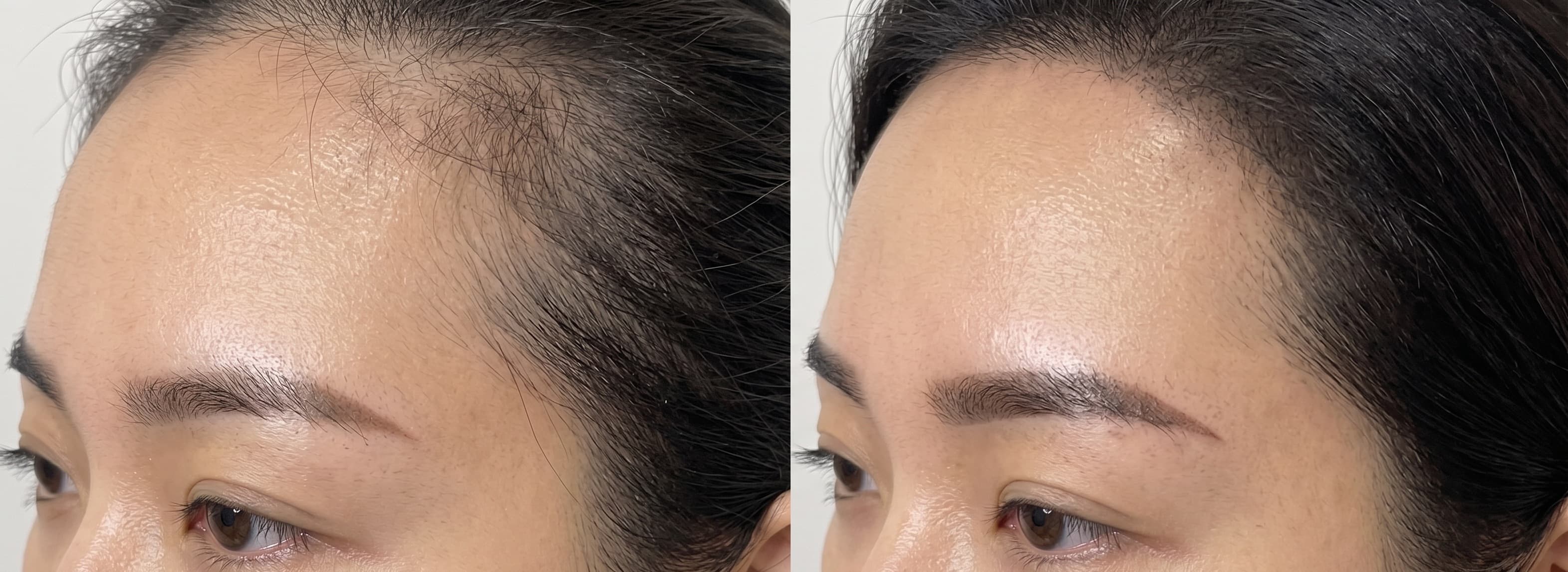 before-after