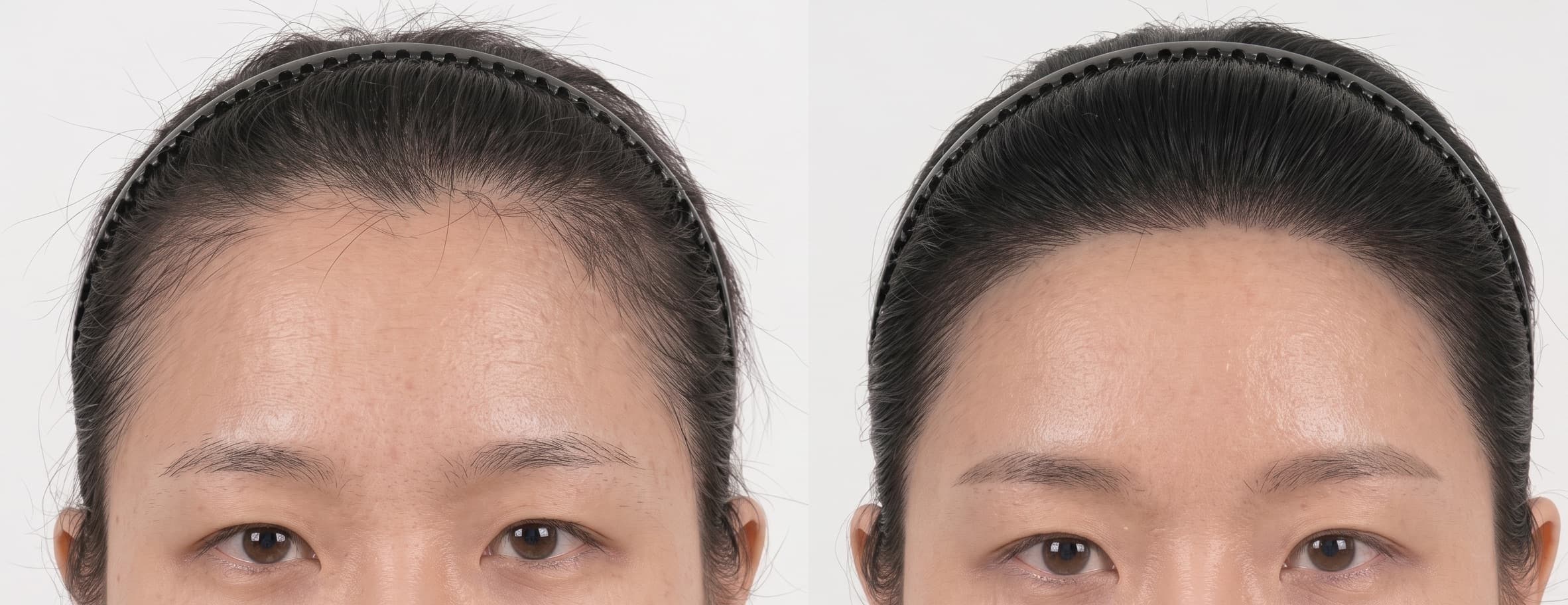 before-after