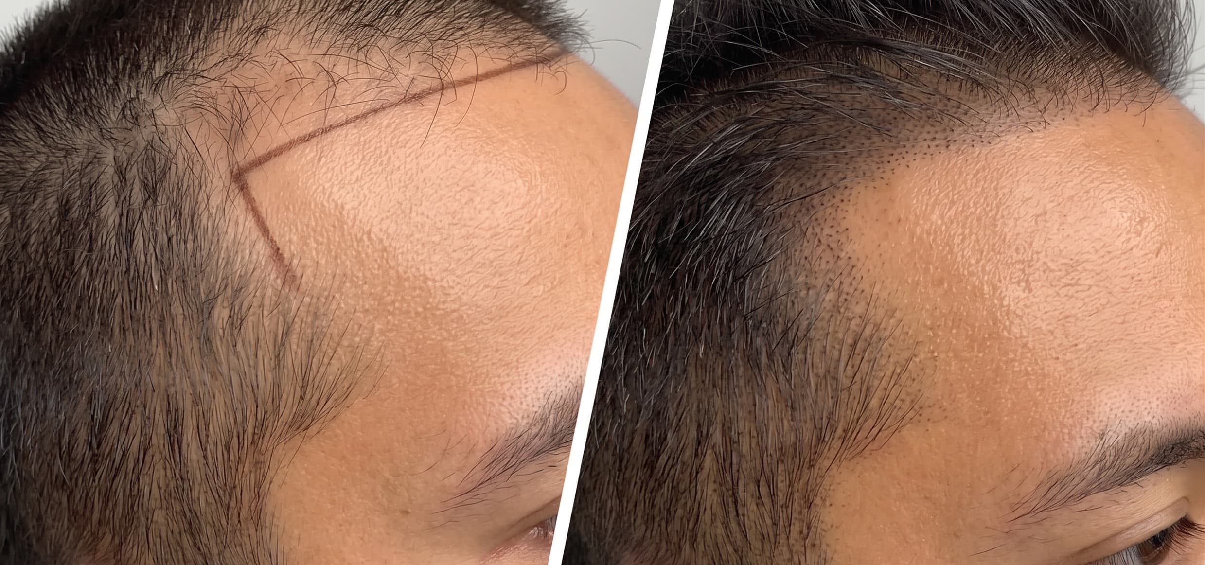 before-after