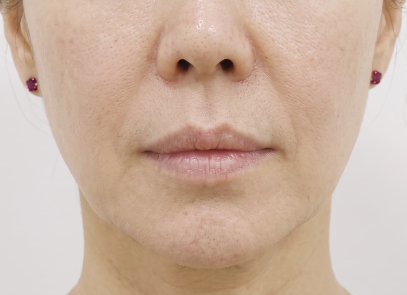 before-after
