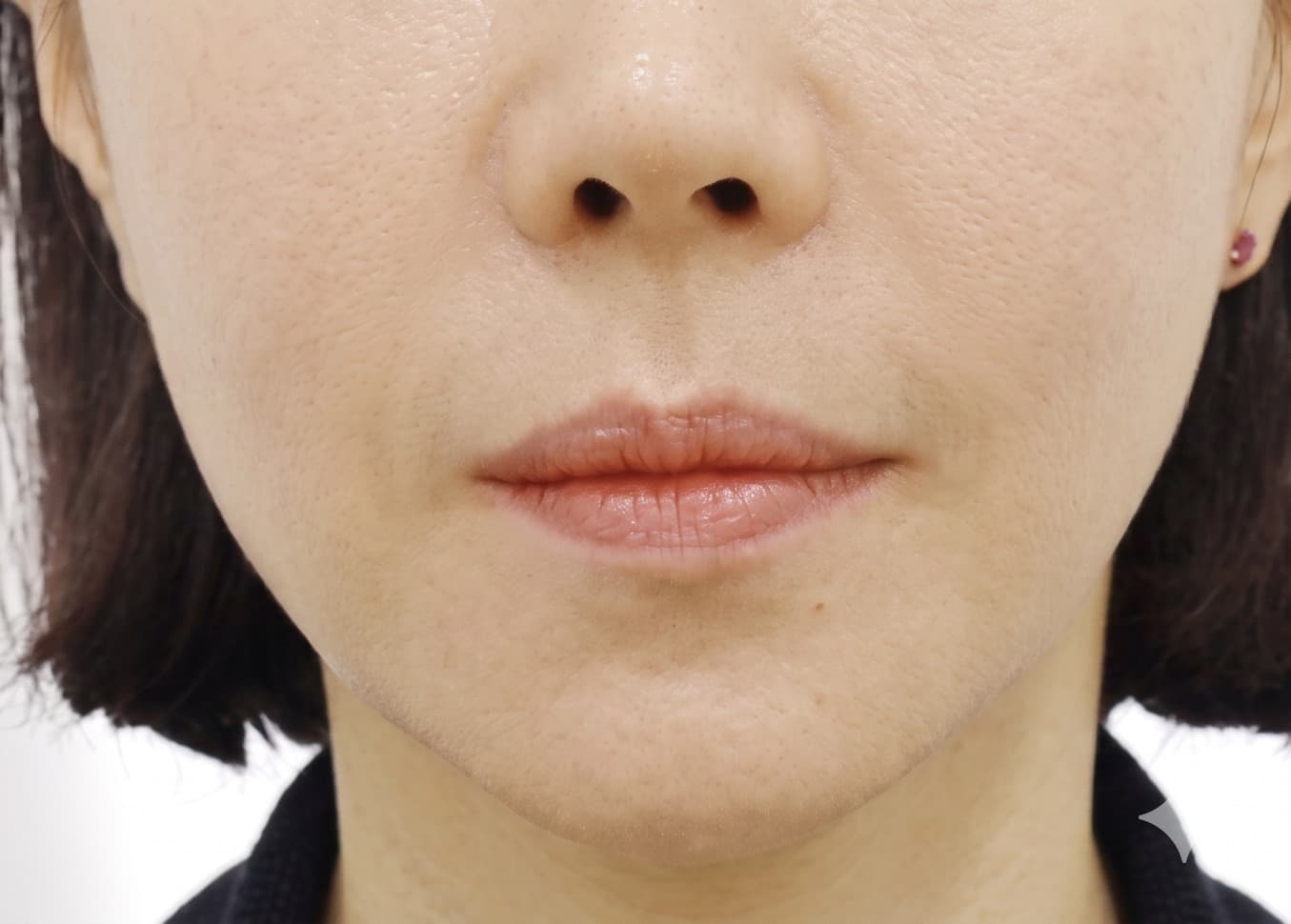 before-after