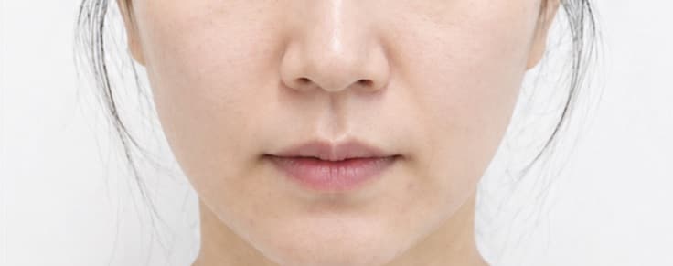 before-after